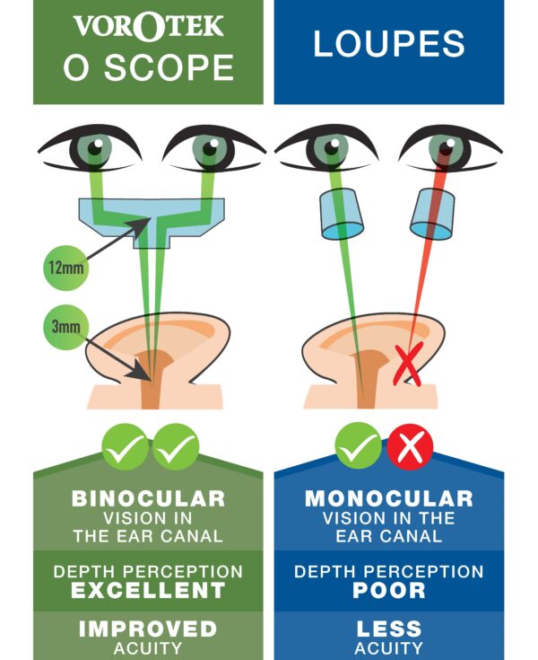 The Vorotek O Scope brings both eyes together so you can look with both eyes down a narrow canal such as an ear or a nose.